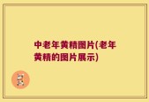 中老年黄精图片(老年黄精的图片展示)