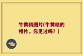 牛黄精图片(牛黄精的相片，你见过吗？)