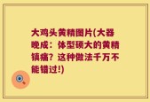 大鸡头黄精图片(大器晚成：体型硕大的黄精镇痛？这种做法千万不能错过!)