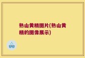 熟山黄精图片(熟山黄精的图像展示)