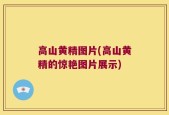 高山黄精图片(高山黄精的惊艳图片展示)