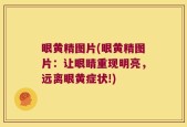 眼黄精图片(眼黄精图片：让眼睛重现明亮，远离眼黄症状!)