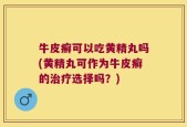 牛皮癣可以吃黄精丸吗(黄精丸可作为牛皮癣的治疗选择吗？)