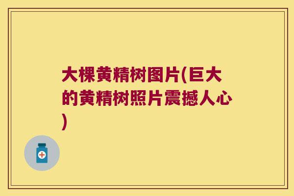 大棵黄精树图片(巨大的黄精树照片震撼人心) 大棵黄精树图片(巨大的黄精树照片震撼人心)