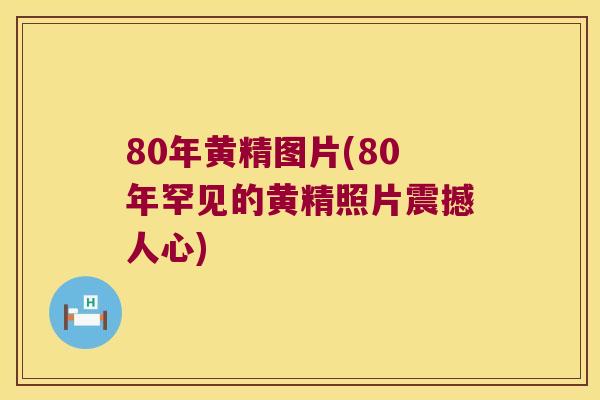 80年黄精图片(80年罕见的黄精照片震撼人心) 80年黄精图片(80年罕见的黄精照片震撼人心)