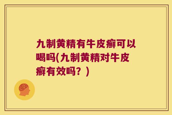 九制黄精有牛皮癣可以喝吗(九制黄精对牛皮癣有效吗?) 九制黄精有牛皮癣可以喝吗(九制黄精对牛皮癣有效吗?)
