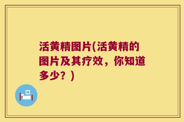 活黄精图片(活黄精的图片及其疗效,你知道多少?) 活黄精图片(活黄精的图片及其疗效,你知道多少?)