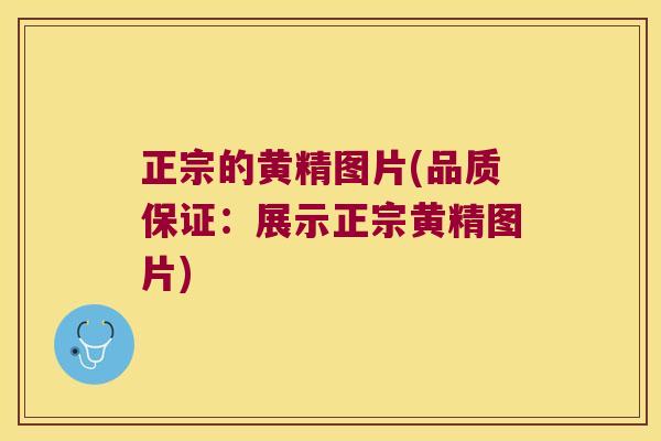 正宗的黄精图片(品质保证:展示正宗黄精图片) 正宗的黄精图片(品质保证:展示正宗黄精图片)