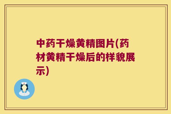 干燥黄精图片(药材黄精干燥后的样貌展示) 干燥黄精图片(药材黄精干燥后的样貌展示)