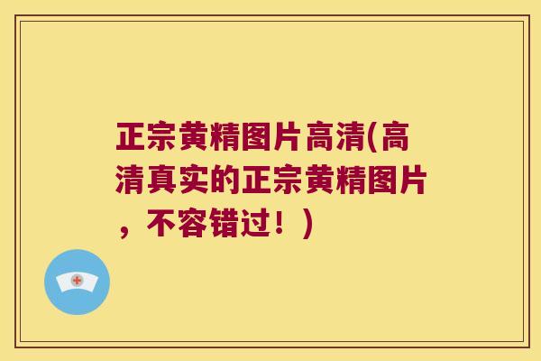 正宗黄精图片高清(高清真实的正宗黄精图片,不容错过!) 正宗黄精图片高清(高清真实的正宗黄精图片,不容错过!)