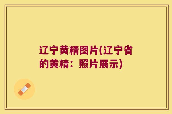 辽宁黄精图片(辽宁省的黄精:照片展示) 辽宁黄精图片(辽宁省的黄精:照片展示)