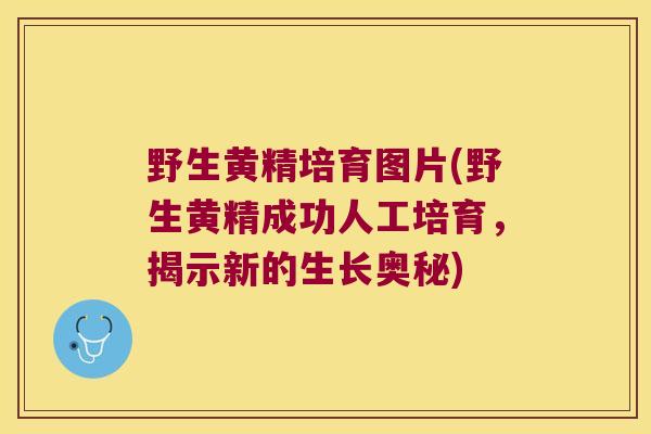 野生黄精培育图片(野生黄精成功人工培育,揭示新的生长奥秘) 野生黄精培育图片(野生黄精成功人工培育,揭示新的生长奥秘)
